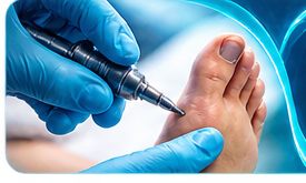Tratamento podológico profissional